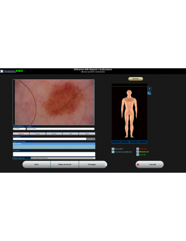 Molemax HD digitalni videodermatoskop Video dermatoskop Derma Medical Systems