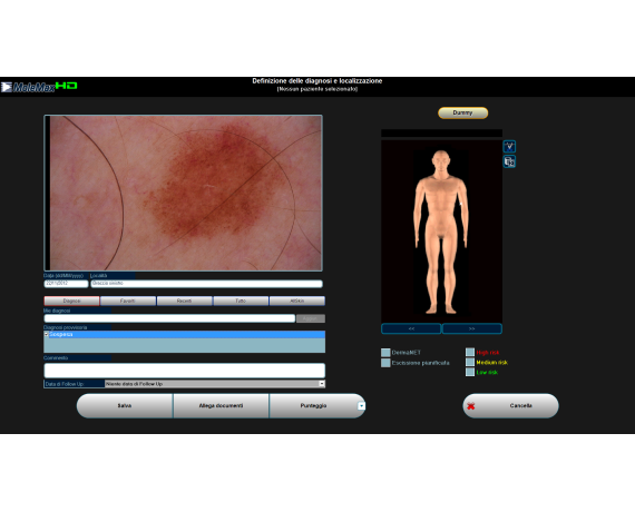 Vidéodermatoscope numérique Molemax HD Dermatoscopes vidéo Derma Medical Systems