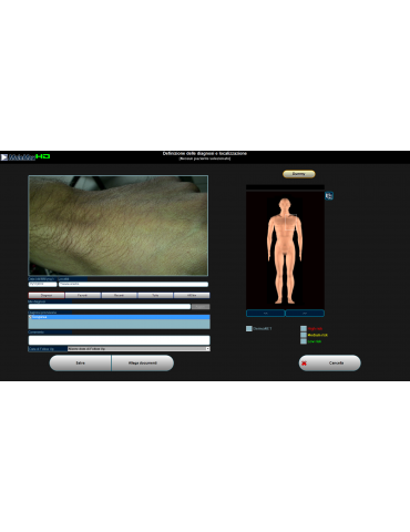Molemax HDVideo Dermatoscopi Derma Systemy medyczne Wideodermatoskop