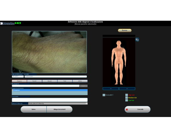 Vidéodermatoscope numérique Molemax HD Dermatoscopes vidéo Derma Medical Systems