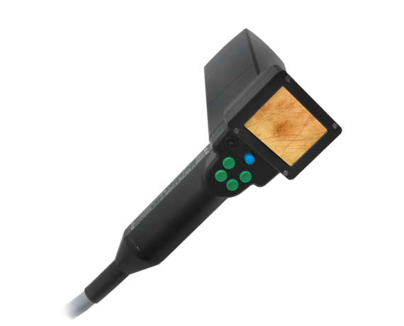 Molemax HD digitális videodermatoszkóp Videó dermatoszkópok Derma Medical Systems