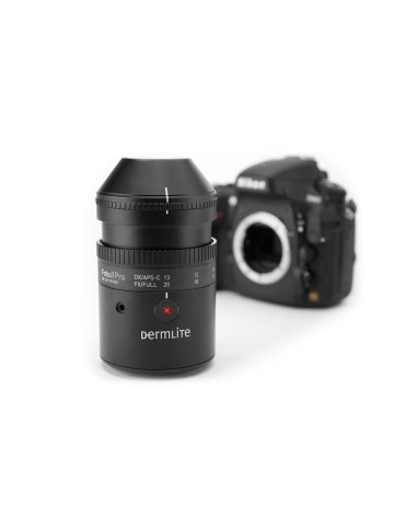 DermLite Foto II Pro digitalt dermatoskopisystem Digital dermatoskopi Dermlite DLF2-PRO