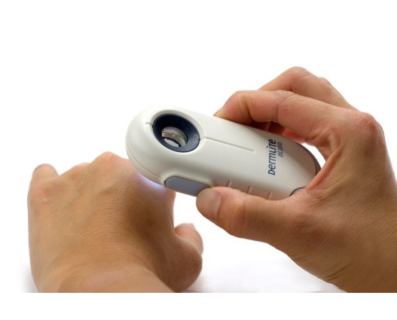DermLite DL100 Dermlite Dermatoscopes Dermlite DL100