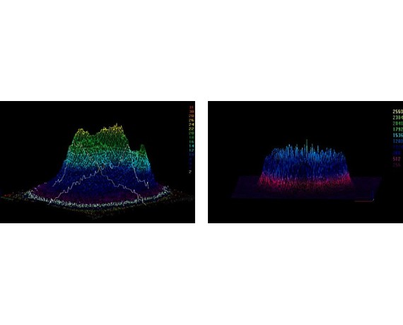 Q-kytkentäinen Nd-Yag-laser Lutronic Spectra XTLaser Q-kytkentäinen Lutronic