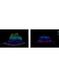 Q-kytkentäinen Nd-Yag-laser Lutronic Spectra XTLaser Q-kytkentäinen Lutronic