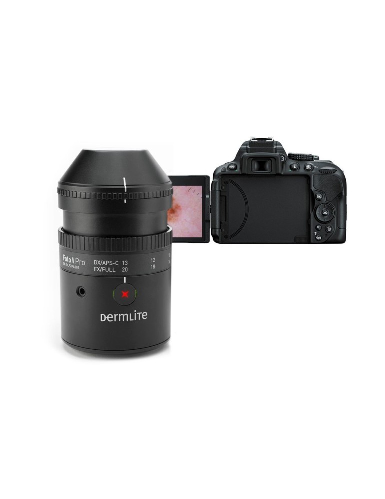 DermLite Foto II Pro Plus digitaalinen dermatoskopiajärjestelmäDigitaalinen dermatoskopia Dermlite DLF2Plus DermLite Foto II Pro Plus digitaalinen dermatoskopiajärjestelmäDigitaalinen dermatoskopia Dermlite DLF2Plus