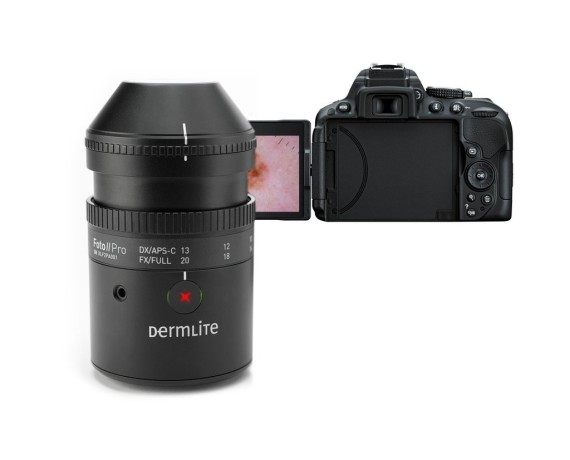 DermLite Foto II Pro Plus digitaalinen dermatoskopiajärjestelmäDigitaalinen dermatoskopia Dermlite DLF2Plus
