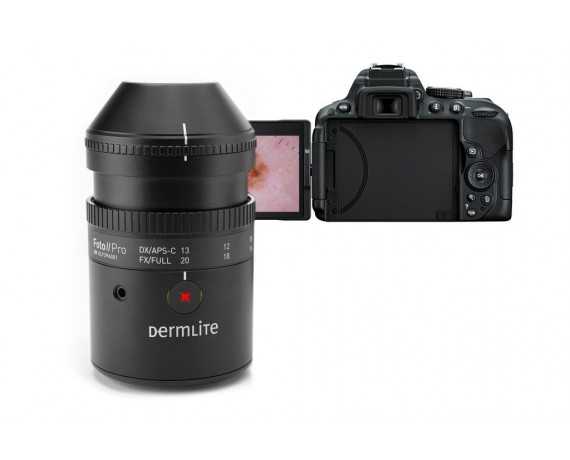 DermLite Foto II Pro Plus digitális dermoszkópos rendszer Digitális dermoszkópia 3Gen DLF2Plus