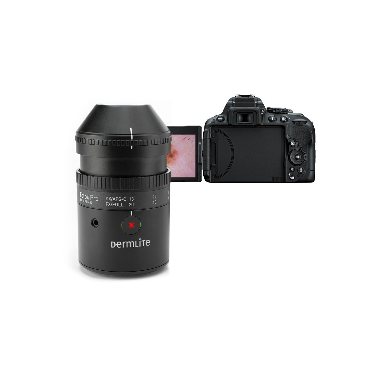 DermLite Foto II Pro Plus digitaalinen dermatoskopiajärjestelmäDigitaalinen dermatoskopia Dermlite DLF2Plus